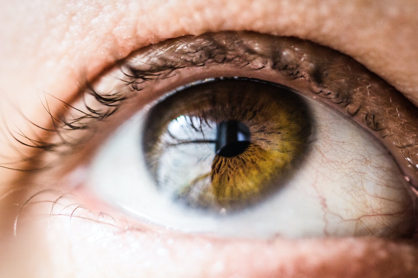 How to Get Rid of Puffy Eyes