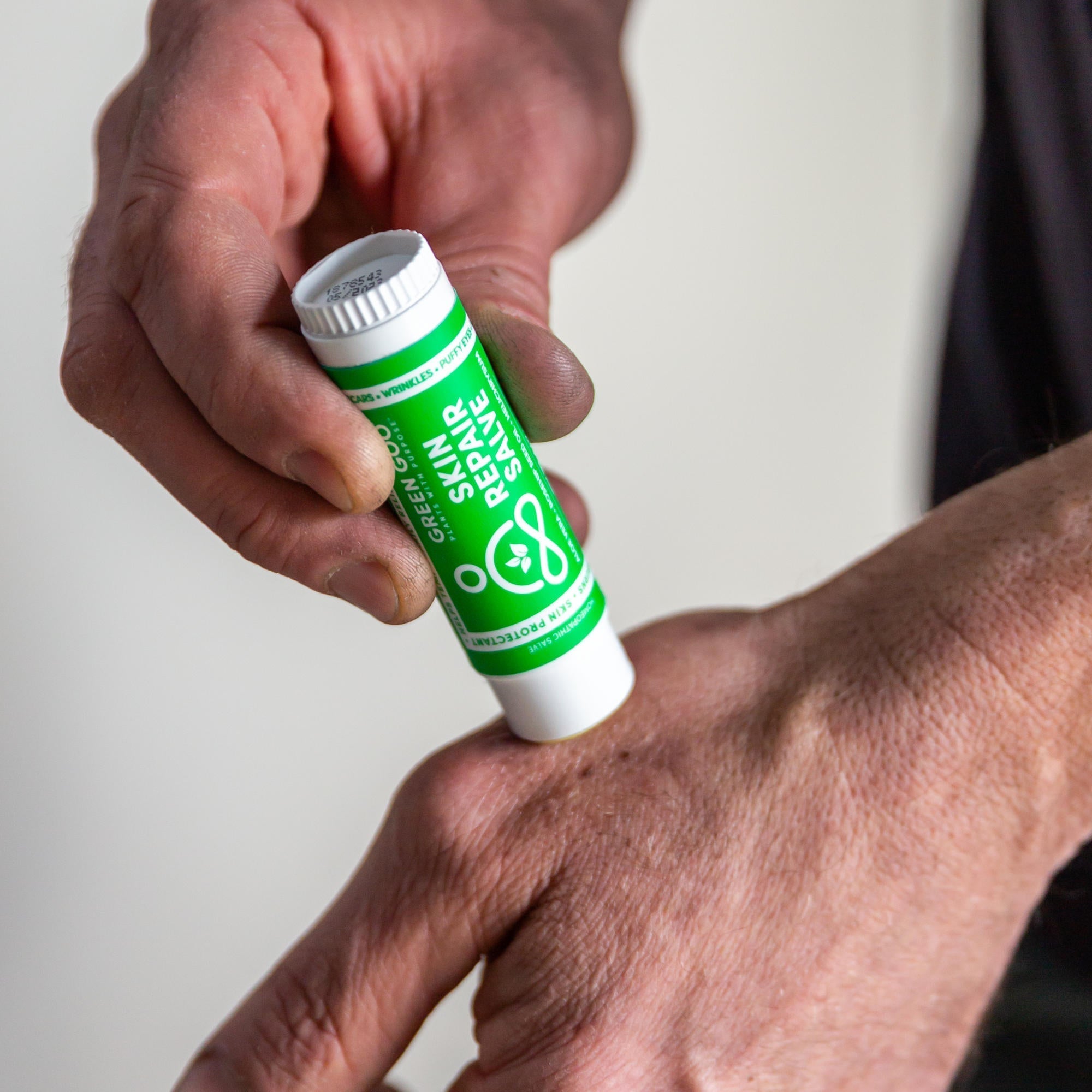 What Helps Cracked Hands? A Practical Skin Support Routine