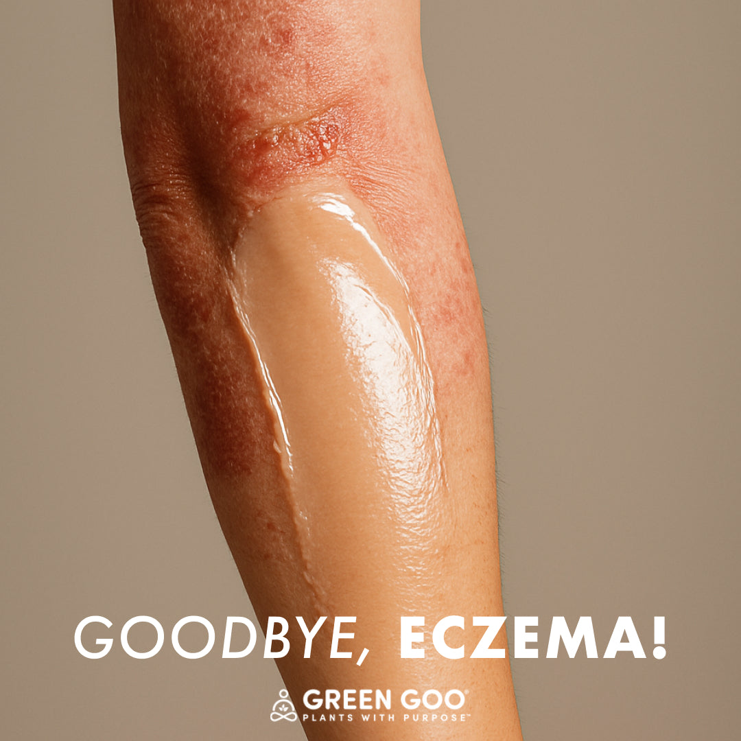 Dry Skin