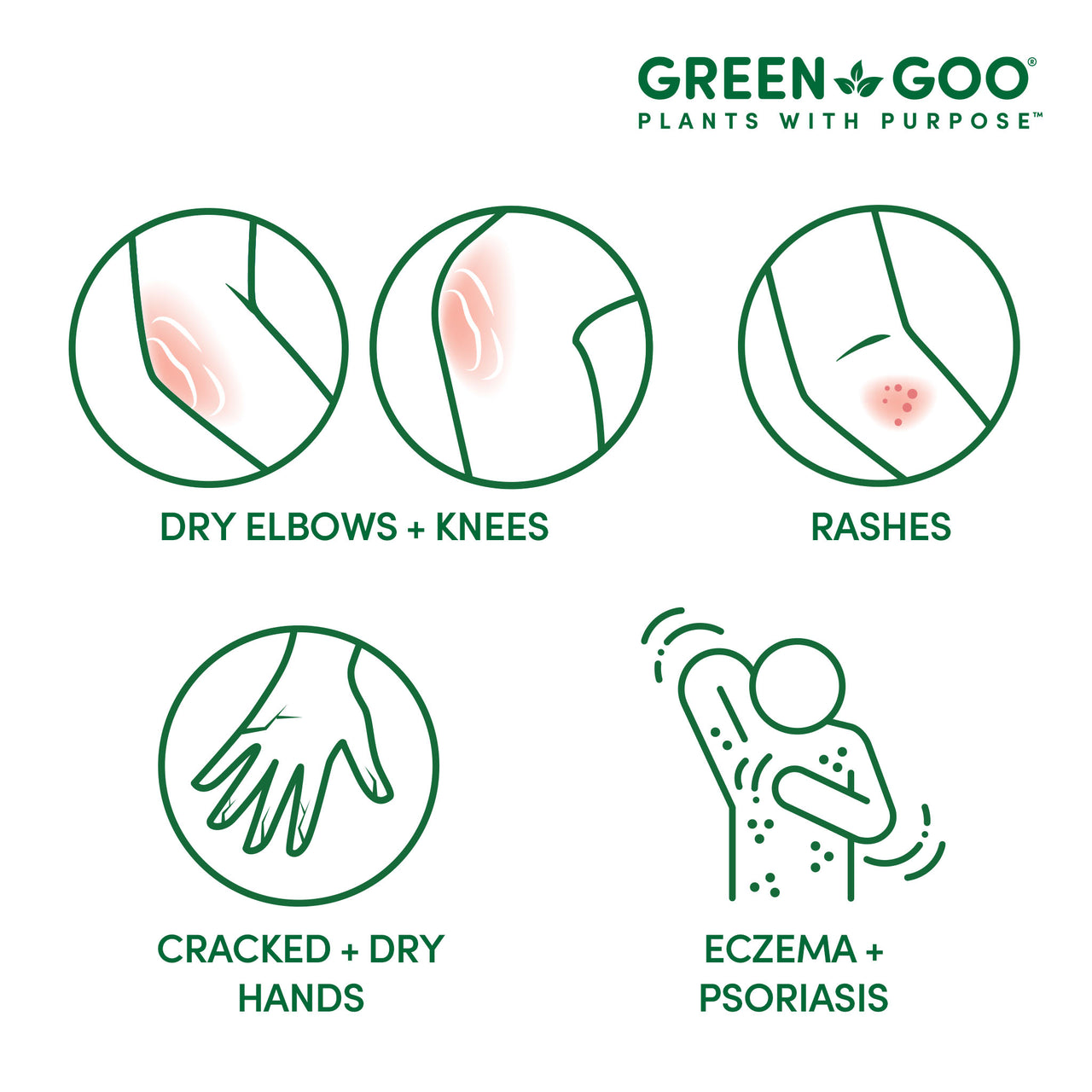 Dry Skin | Green Goo by Sierra Sage Herbs